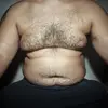 человек-живота-тучный-и-волосатый-26532183.webp